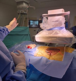 Procedimientos ortho spine center procedimientos