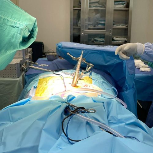 cirugia minima invasion